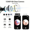 Smart HD Visual Ear Wax Cleaner (WIFI Camera & Otoscope Kit)